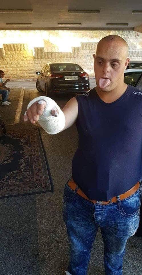 İsrail askerleri down sendromlu Filistinliyi gözaltına aldı